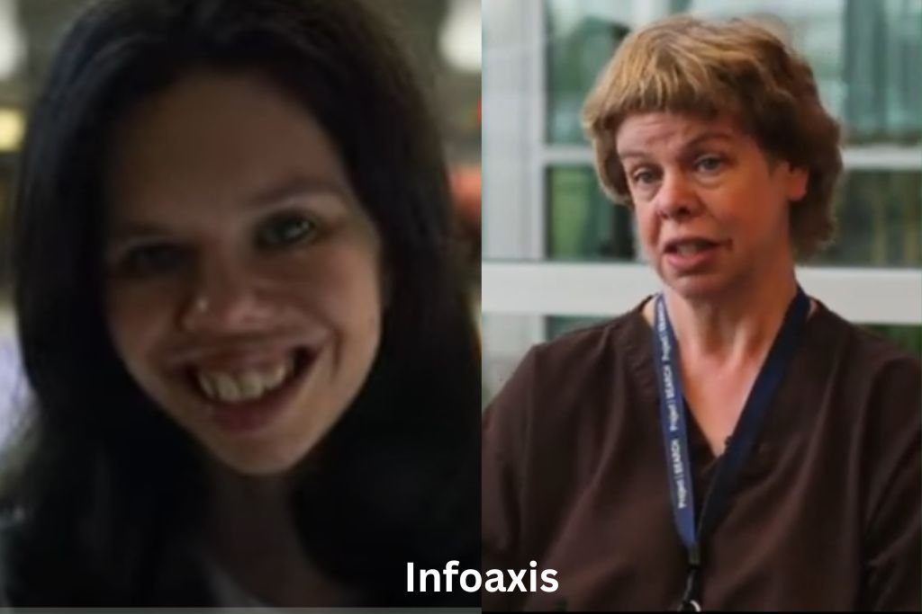 williams syndrome famous people